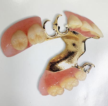 Partial dentures with metal clasps on white table