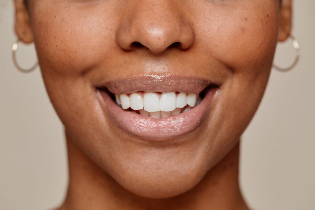 Woman smiling | Featured Image for the How to Make Your Teeth Stronger: Our Favourite Tips blog from Pearl Denture Studio.